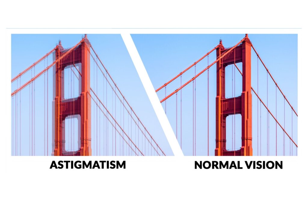A comparison view of normal clear vision versus blurry vision with astigmatism.