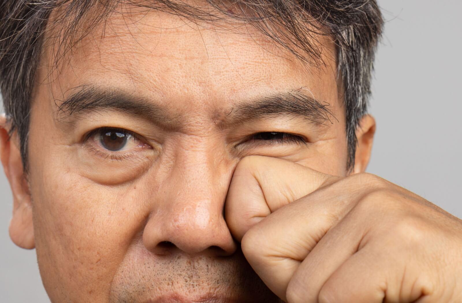 A person rubbing one eye, experiencing symptoms related to antibiotic usage.